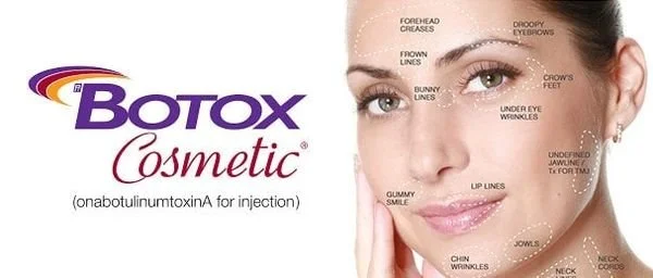 Image of a woman with markings of all the areas botox can be used on her face