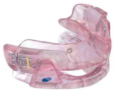Image of a dental mandibular advancement device for OSA