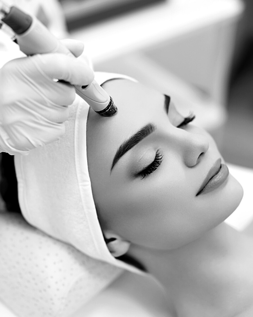 Benefits of Microdermabrasion
