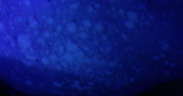 Tinea versicolor diagnosis and treatment comparison - what the peer-reviewed science says. 