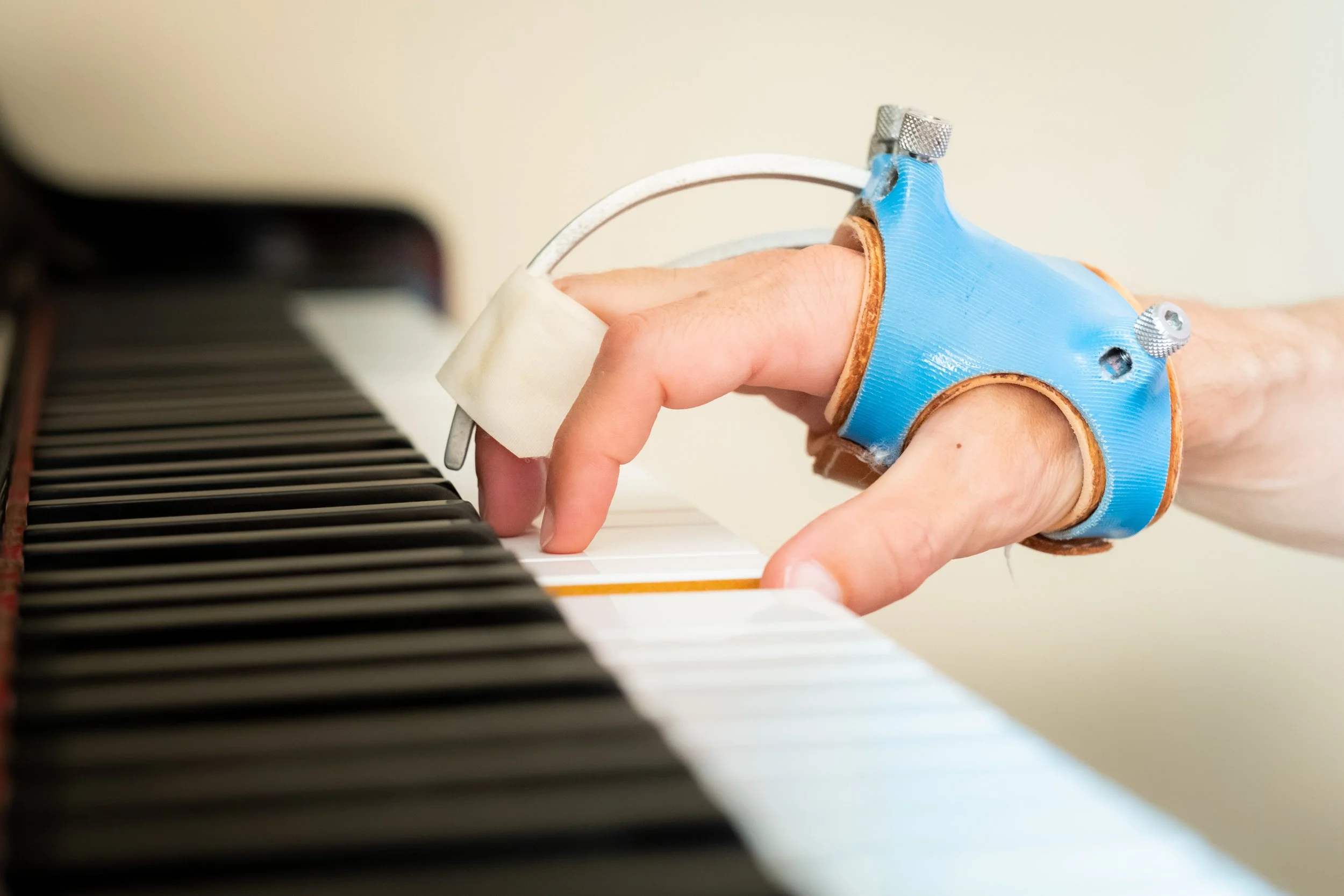 How Occupational Therapy Can Help with The Physical and Physiological Implications of Hand Injuries & Conditions