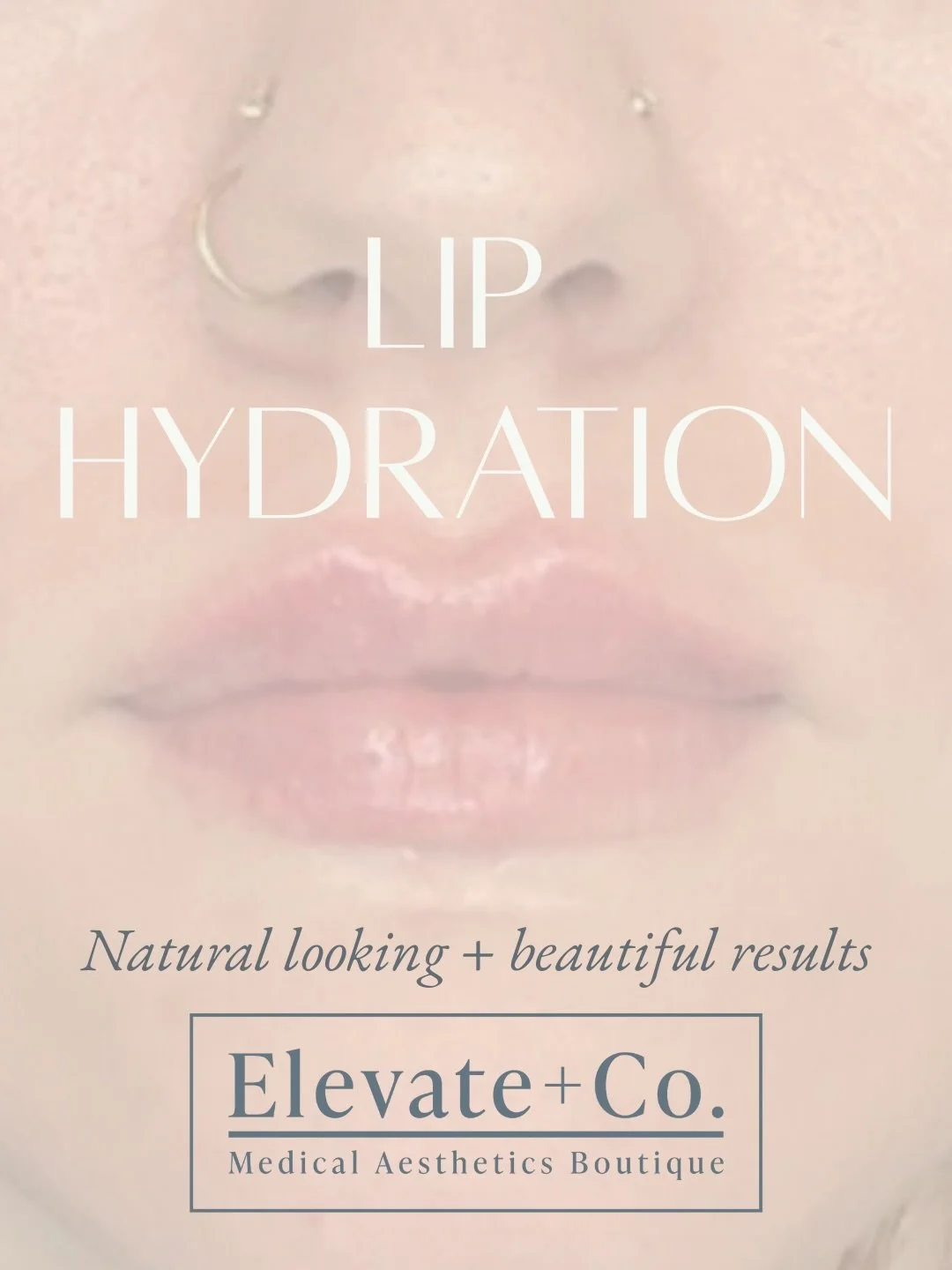 Soft, hydrated, never overdone 💧💋

At Elevate + Co., lip filler is all about balance + hydration &mdash; not volume for the sake of volume. We focus on restoring structure, smoothing fine lines, and creating that fresh, naturally plump look that st