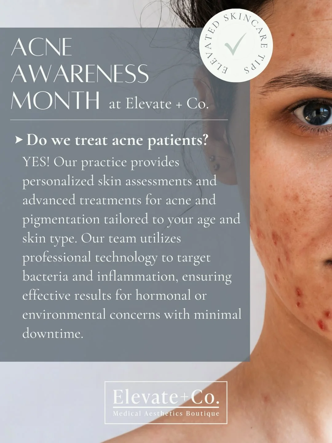 Those struggling with acne. We see you and feel you. It is such a challenging skin condition and can really impact daily life. 

As Acne Awareness month is here (hello June!), we&rsquo;re here to support you this month and every month. Acne or not, w