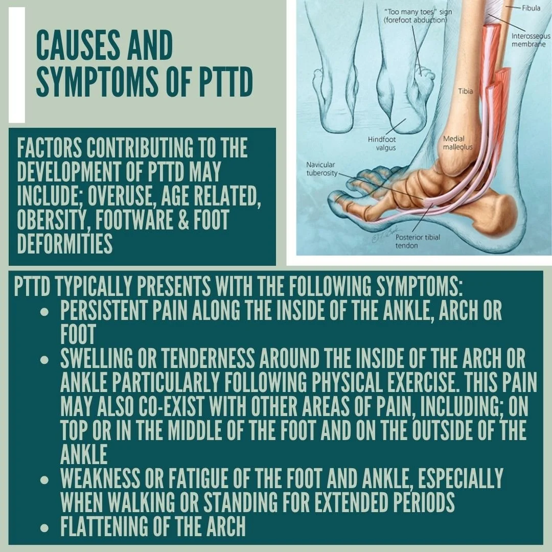 Tibialis Posterior Flat Feet In Adults Acquired Flat Foot