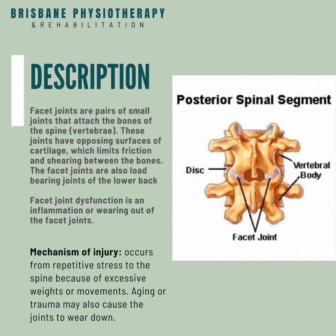 What is Lower Back Facet Joint Dysfunction?