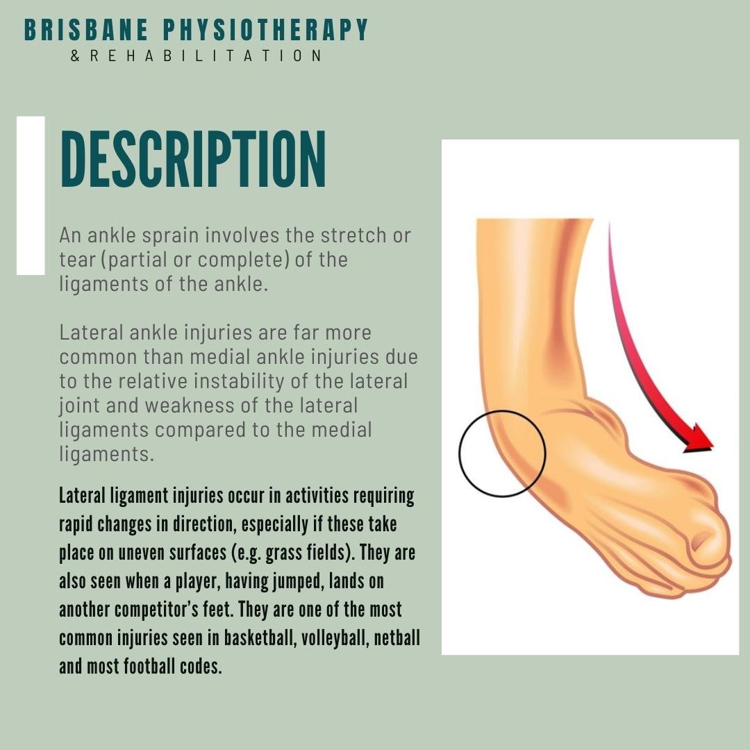 What is an Ankle Sprain? - Brisbane Physiotherapy