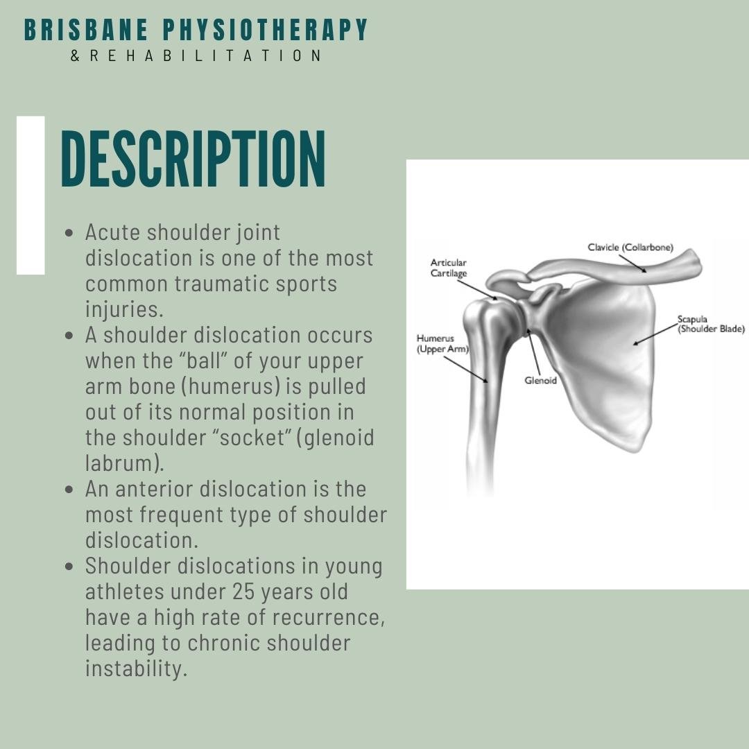 Shoulder Dislocation