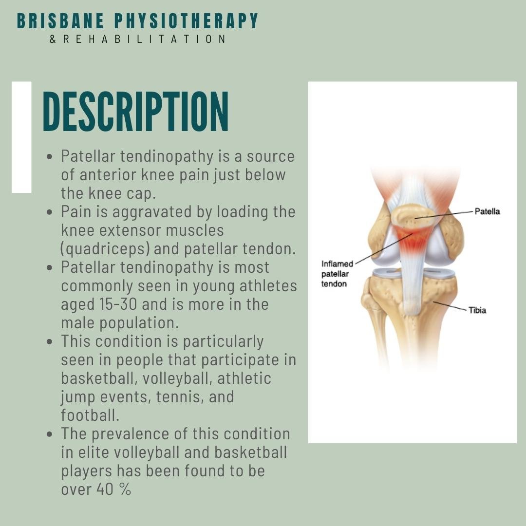 What is Patellar Tendinopathy? - Brisbane Physiotherapy