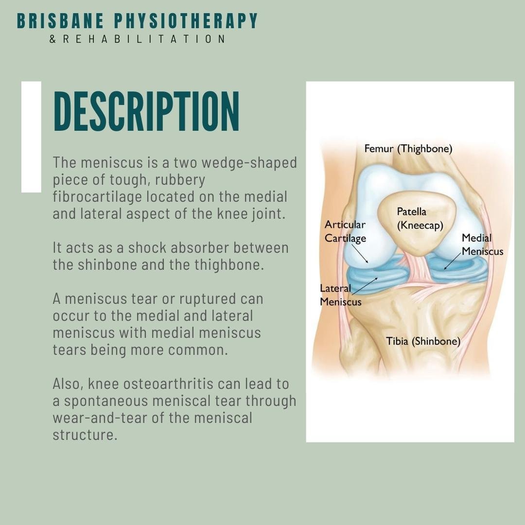 Meniscus Tear/Injury