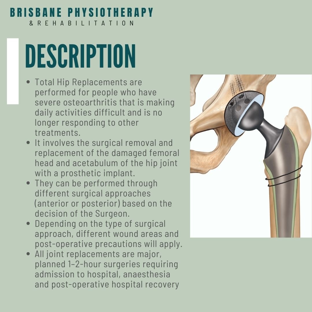 What is a Total Hip Replacement? - Brisbane Physiotherapy