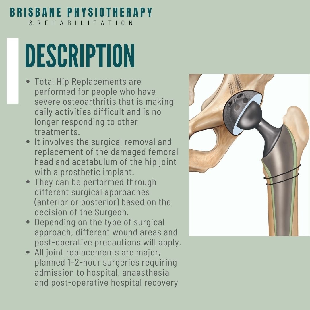 Total Hip Replacement