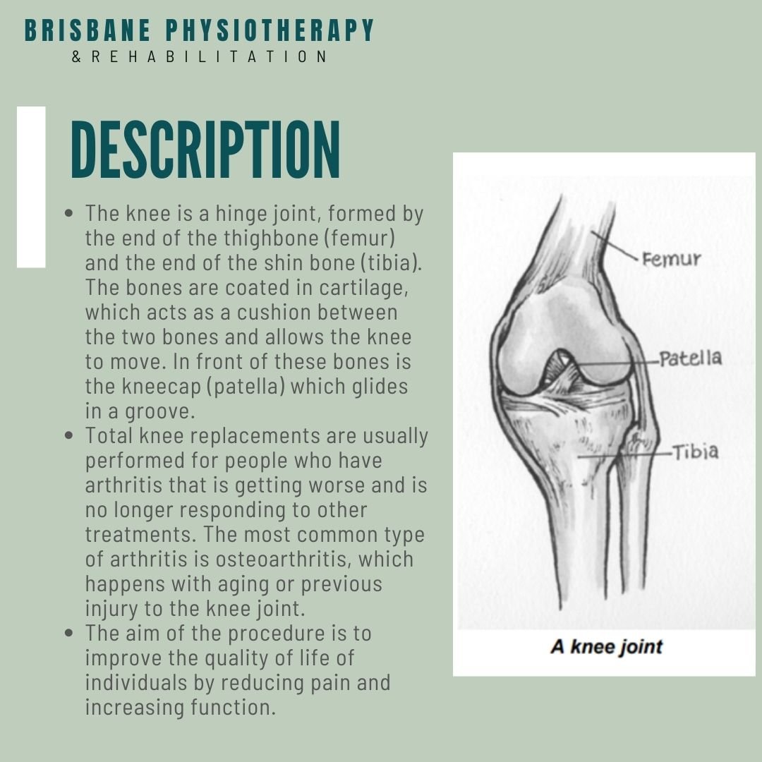 Total Knee Replacement