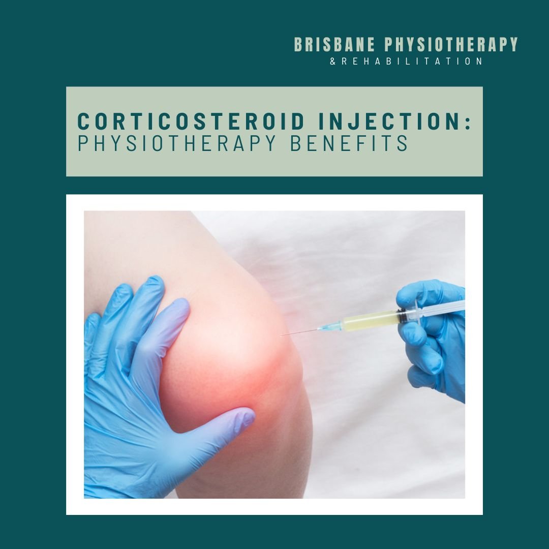 Benefits of Physiotherapy after Corticosteroid Injection