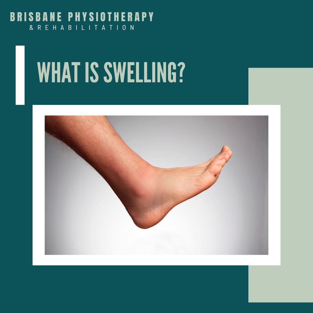 What is Swelling? And Why is it Important after obtaining a Sports Injury?