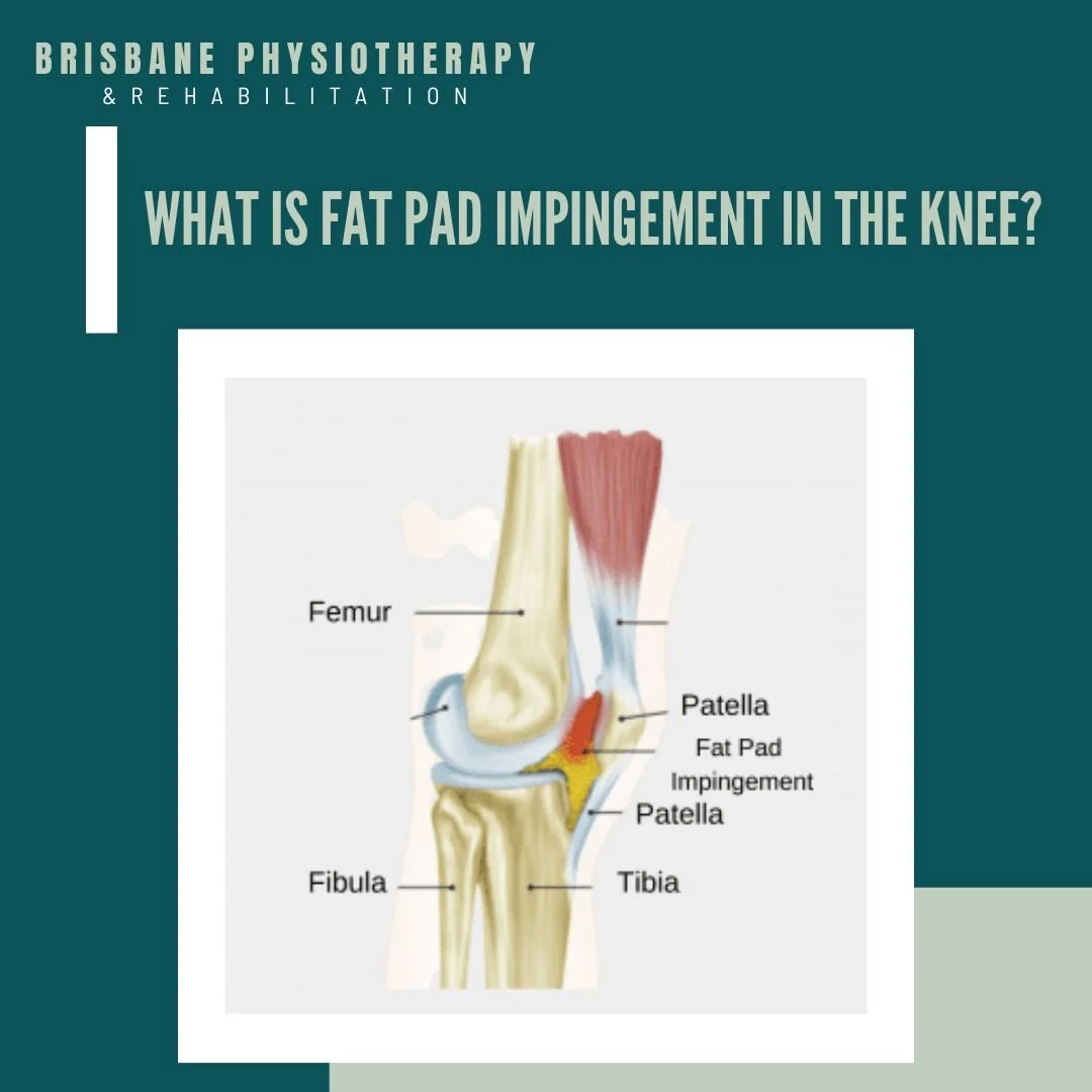 Knee Fat Pad Impingement