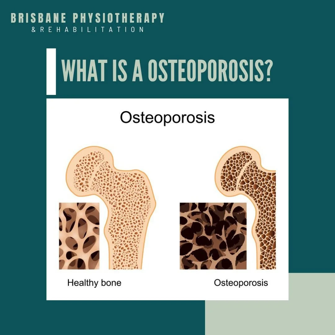 What is Osteoporosis?