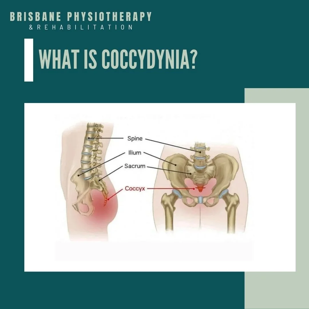 What is Coccydynia?