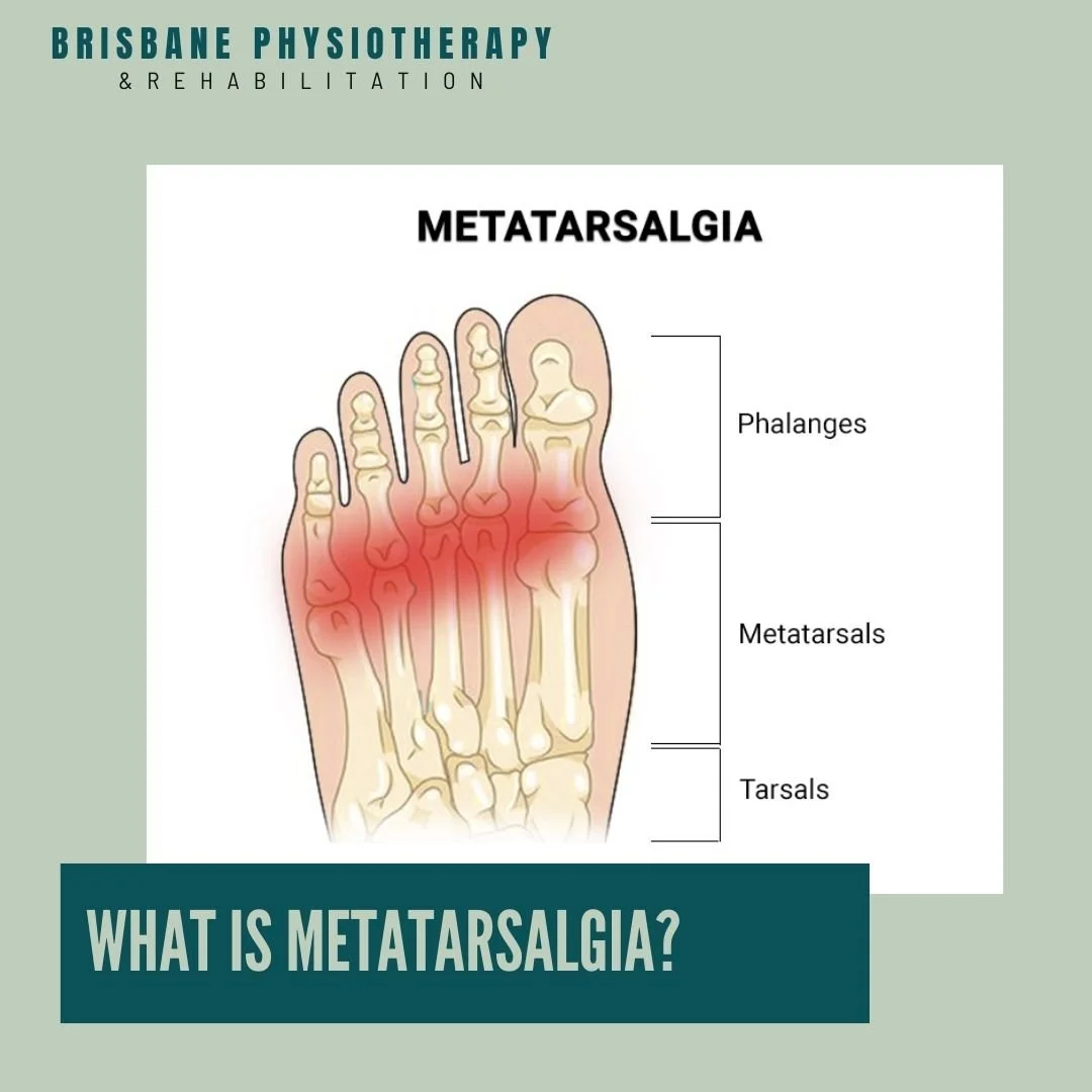 What is Metatarsalgia?