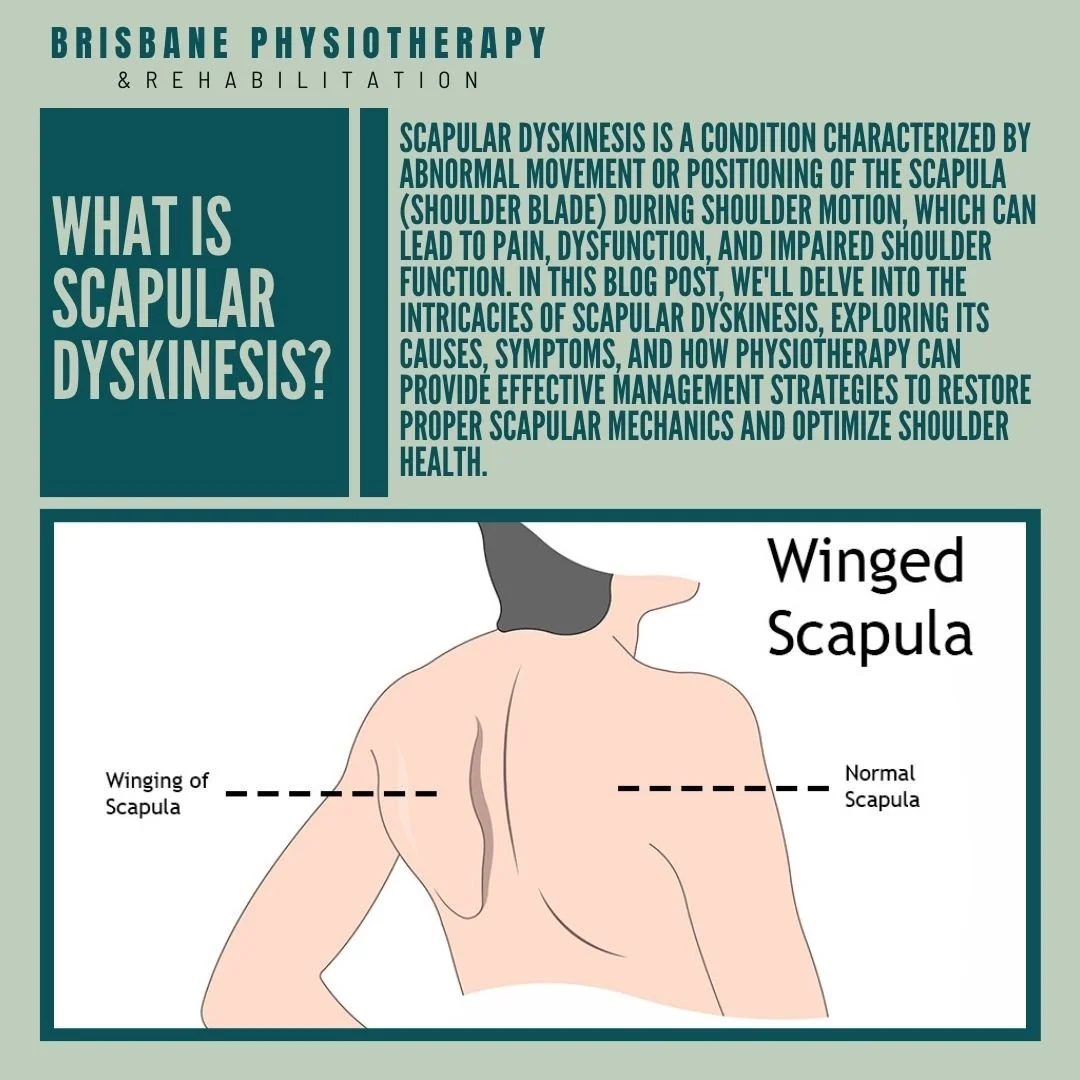 What is Scapular Dyskinesis?