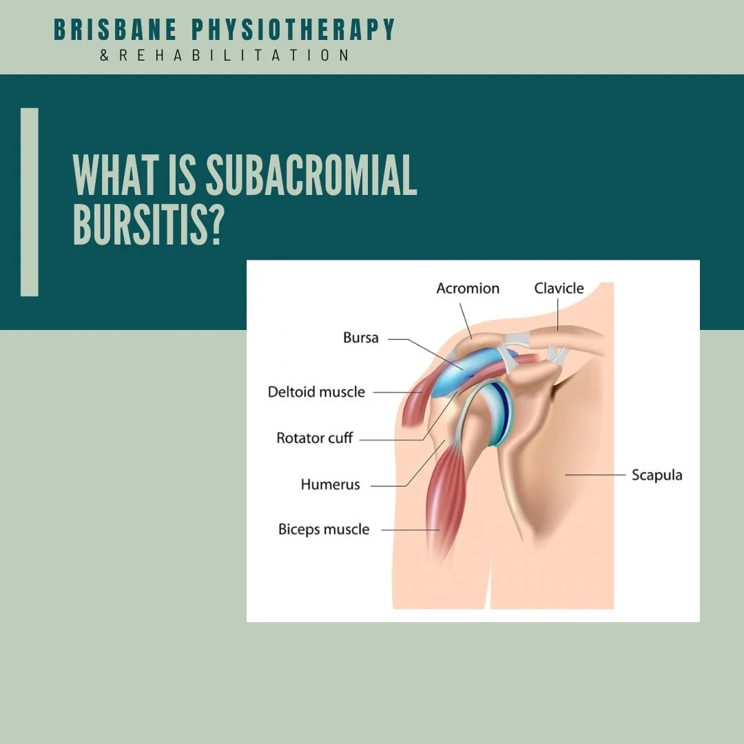 Subacromial Bursitis