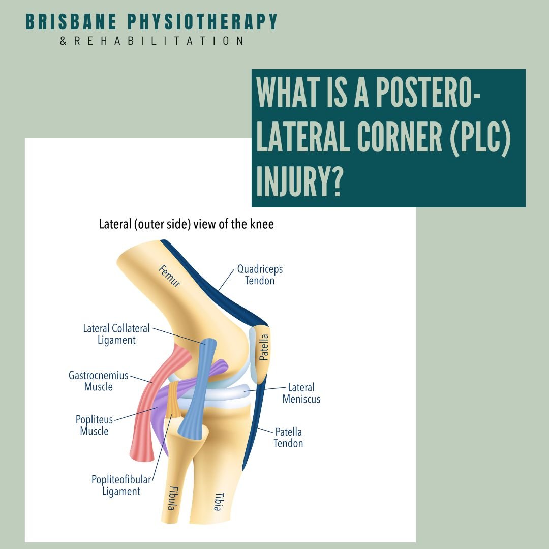 What is a Postero-Lateral Corner Injury?