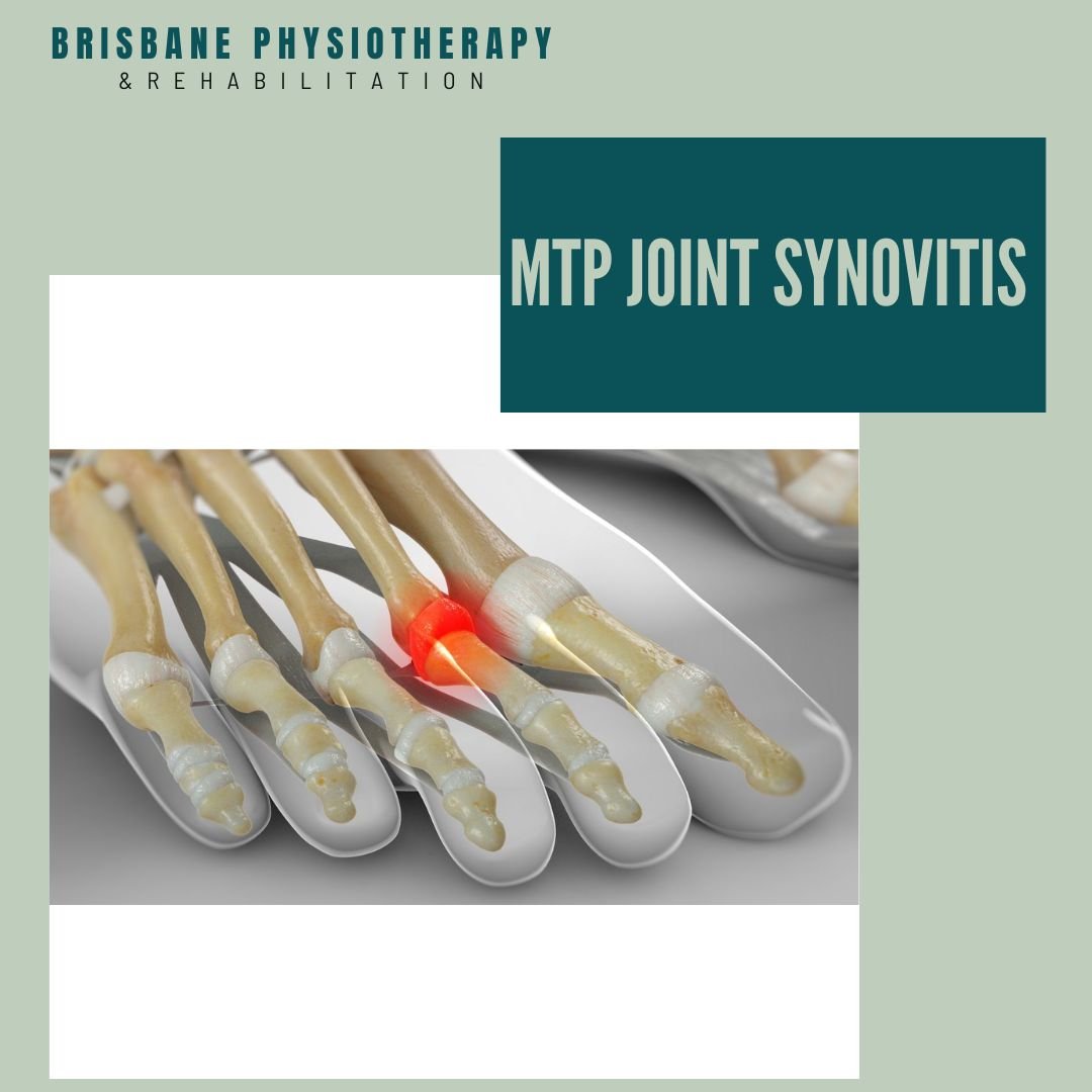 What is Metatarsalphalangeal Joint Synovitis?