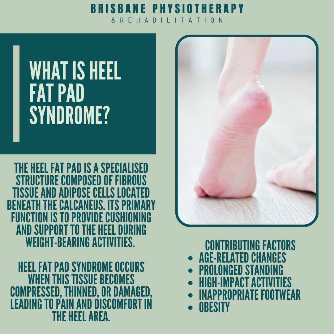 What Is Heel Fat Pad Syndrome?