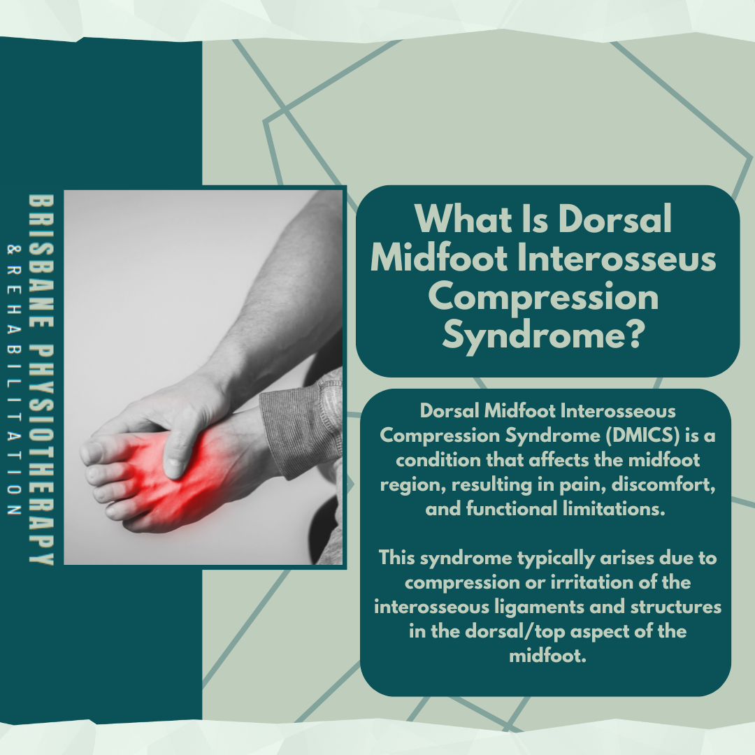 What is Dorsal Midfoot Interosseous Compression Syndrome (DMICS)?