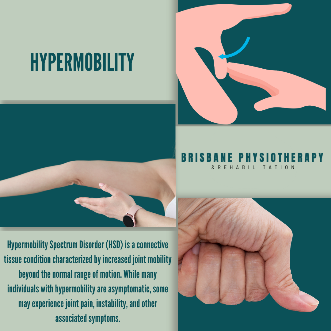 Hypermobility
