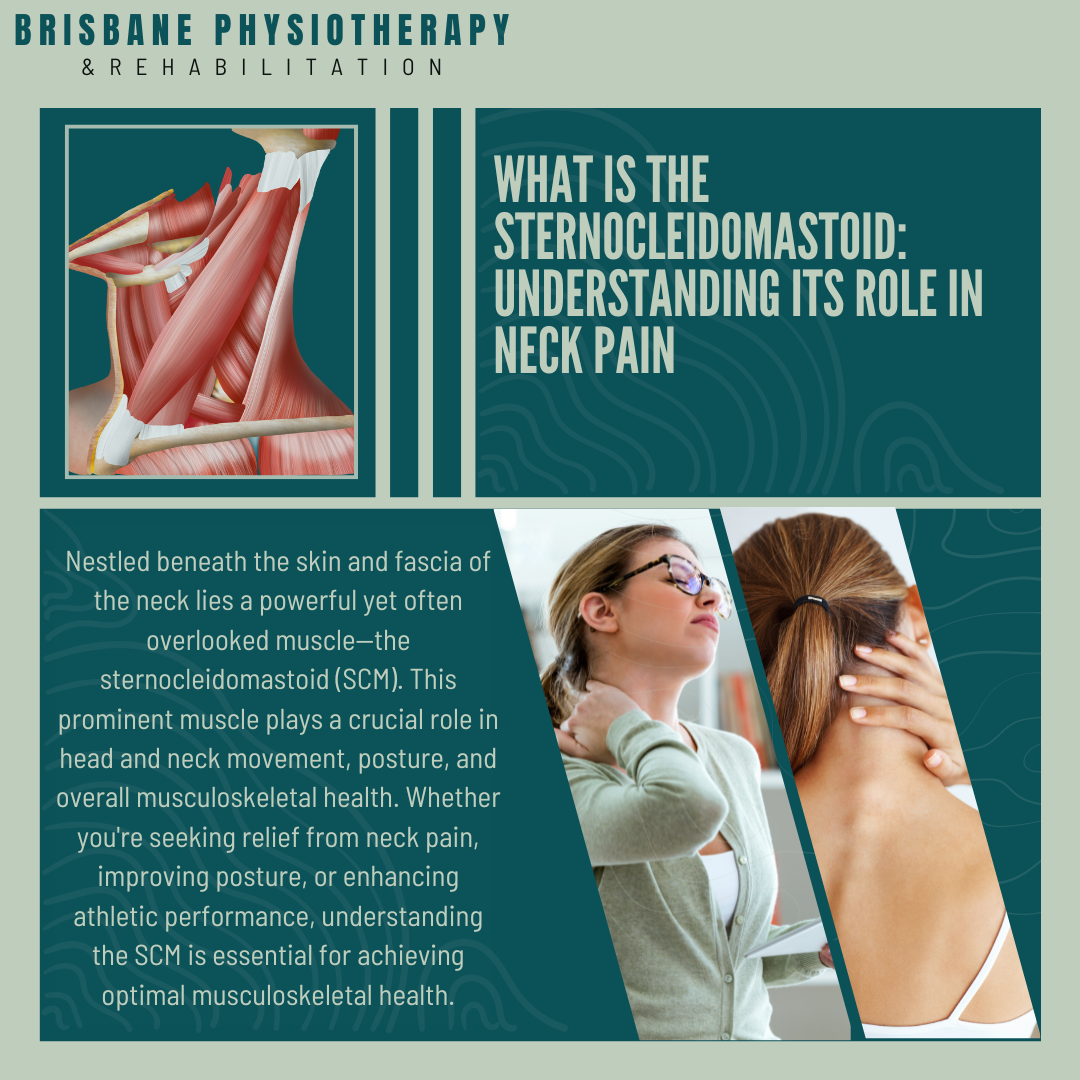 What is the Sternocleidomastoid: Understanding Its Role in neck pain