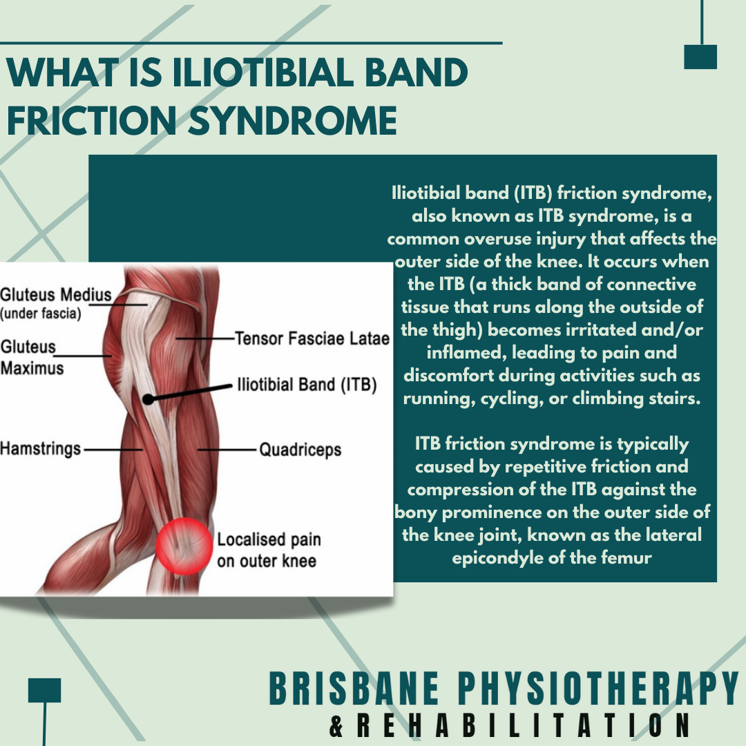 What is Iliotibial Band Friction Syndrome?