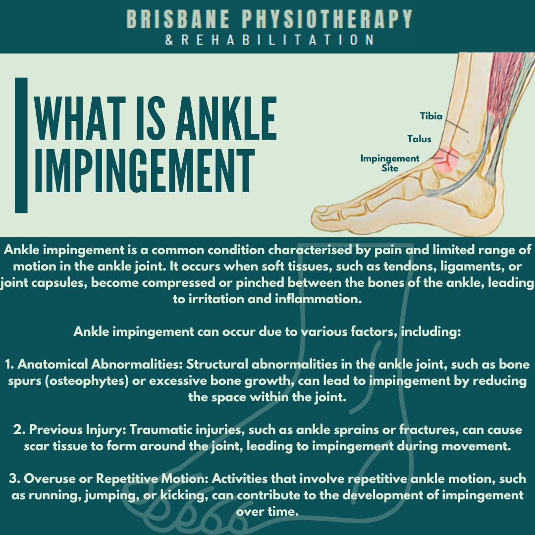 What Is Ankle Impingement