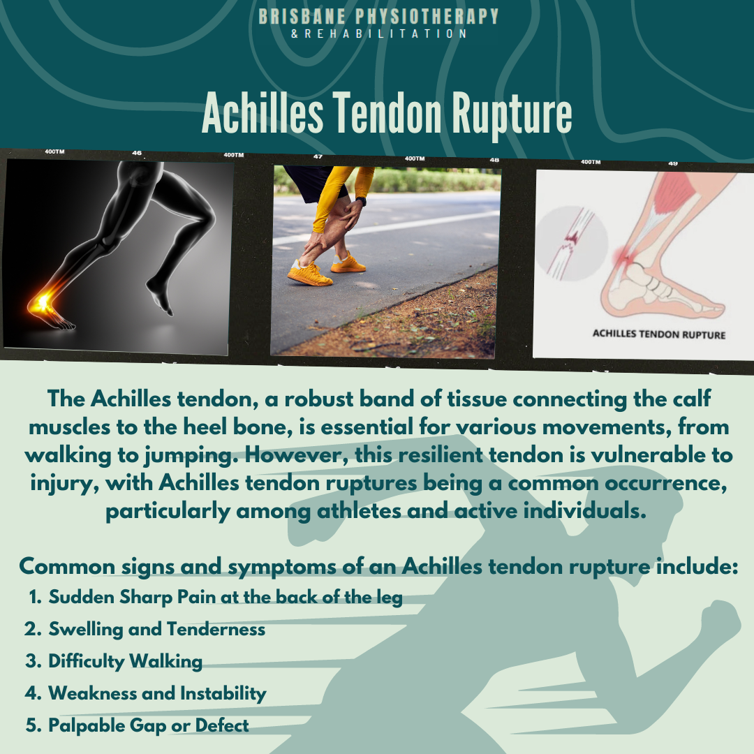 Achilles Tendon Rupture