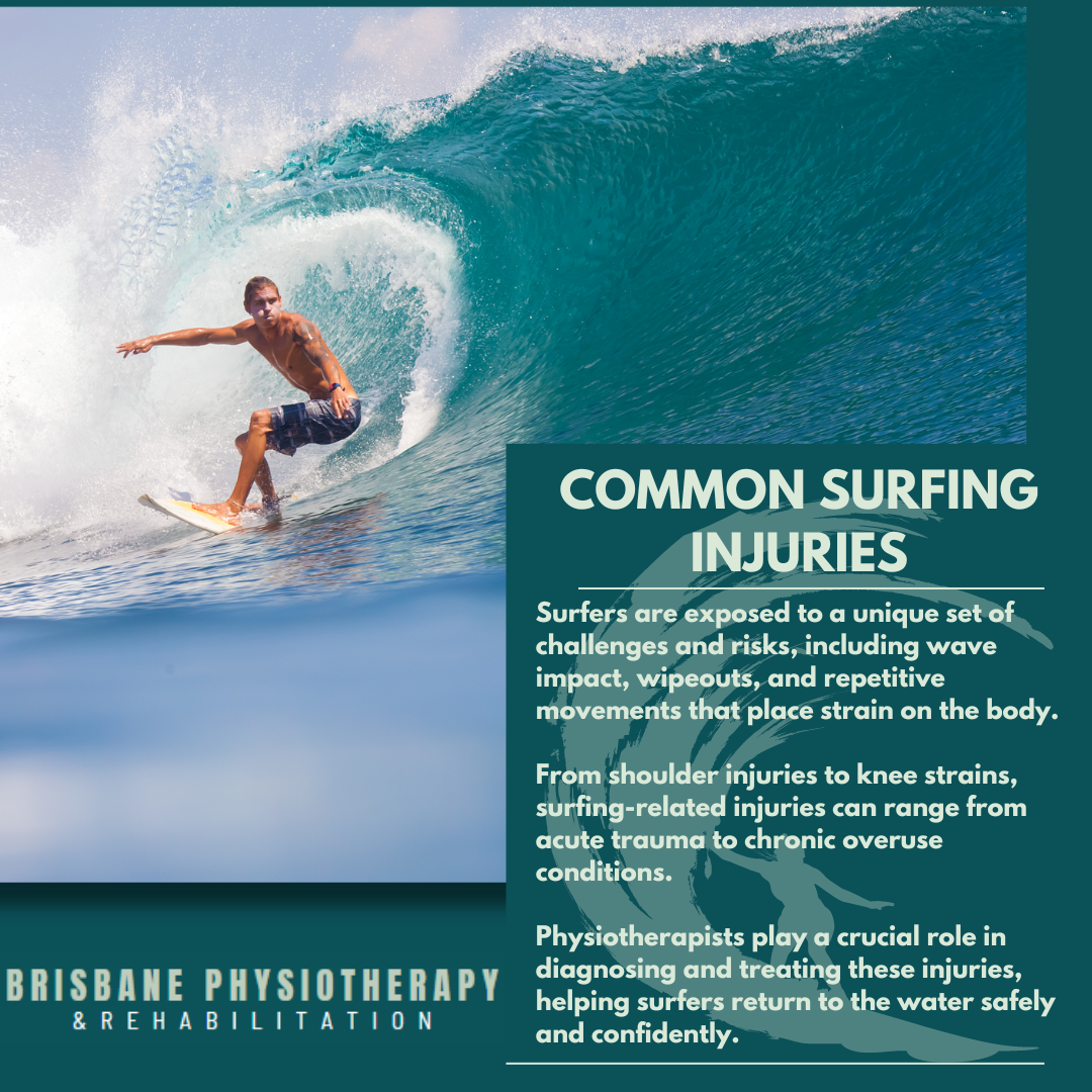 Common Surfing Injuries That Physiotherapists Treat