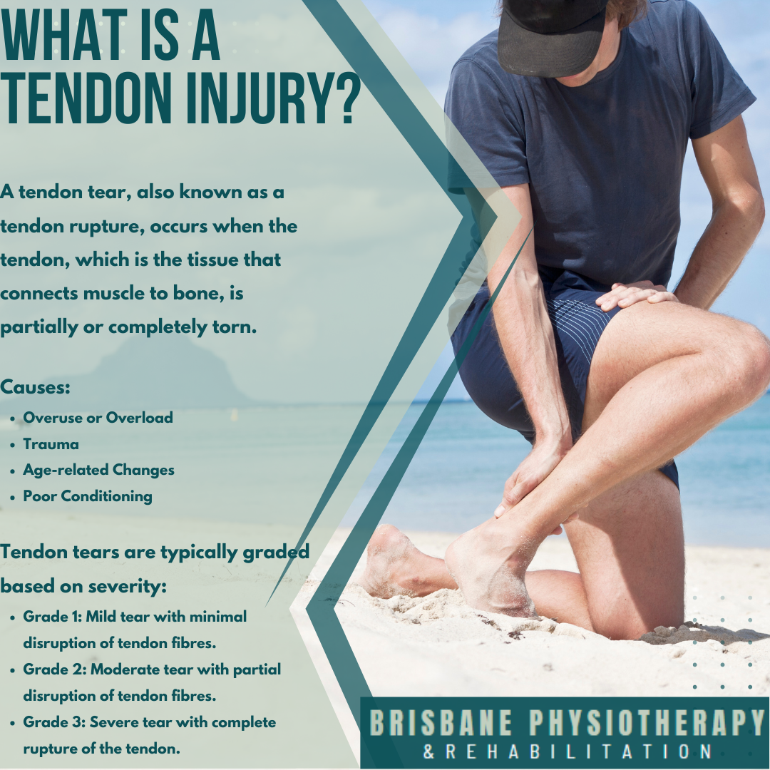 What Is a Tendon Tear?