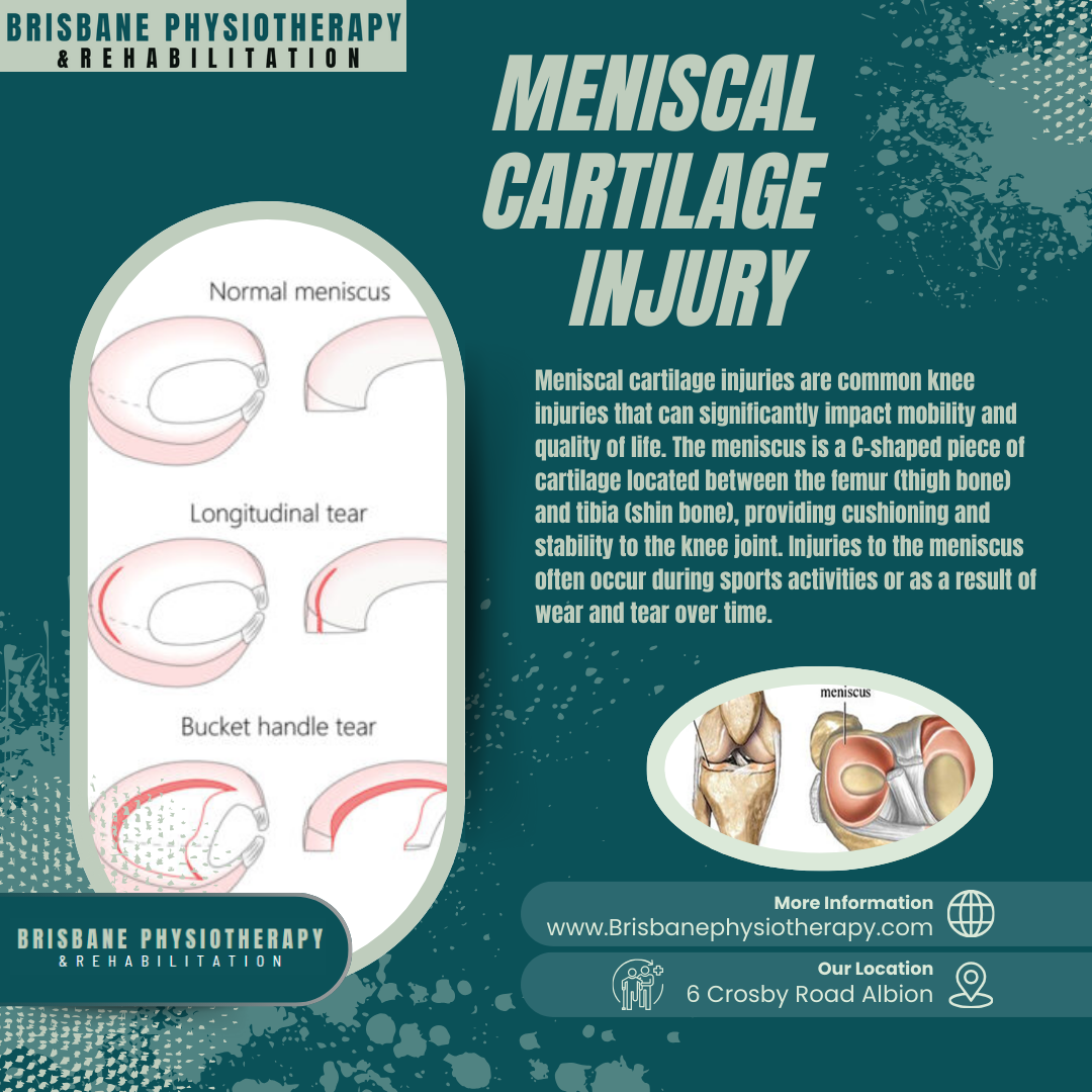 Meniscal Cartilage Injury
