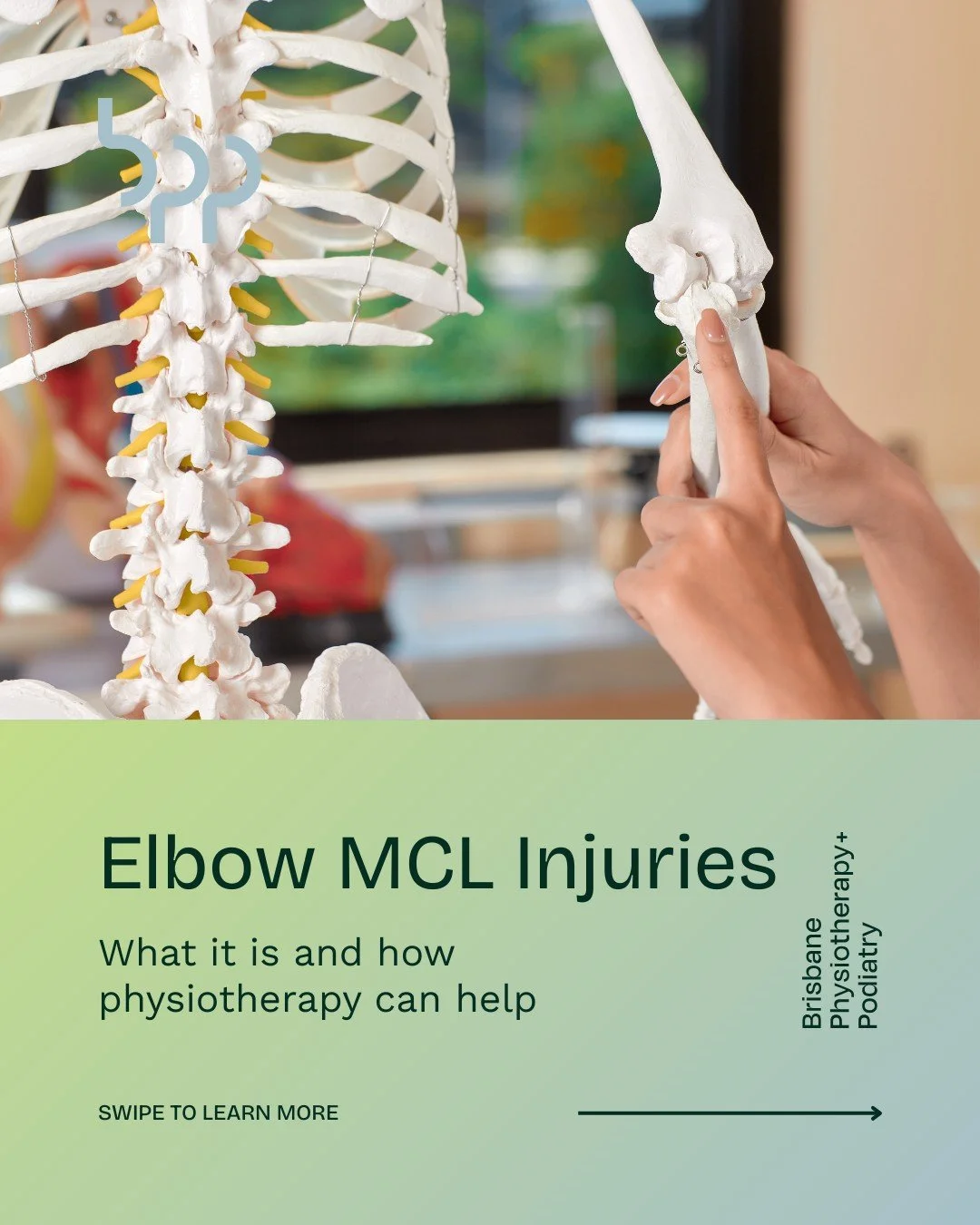 Elbow MCL
Pain on the inside of your elbow that worsens with throwing, pushing, or lifting could be linked to your medial collateral ligament (MCL). This important ligament helps stabilise the elbow during powerful movements, and when injured it can