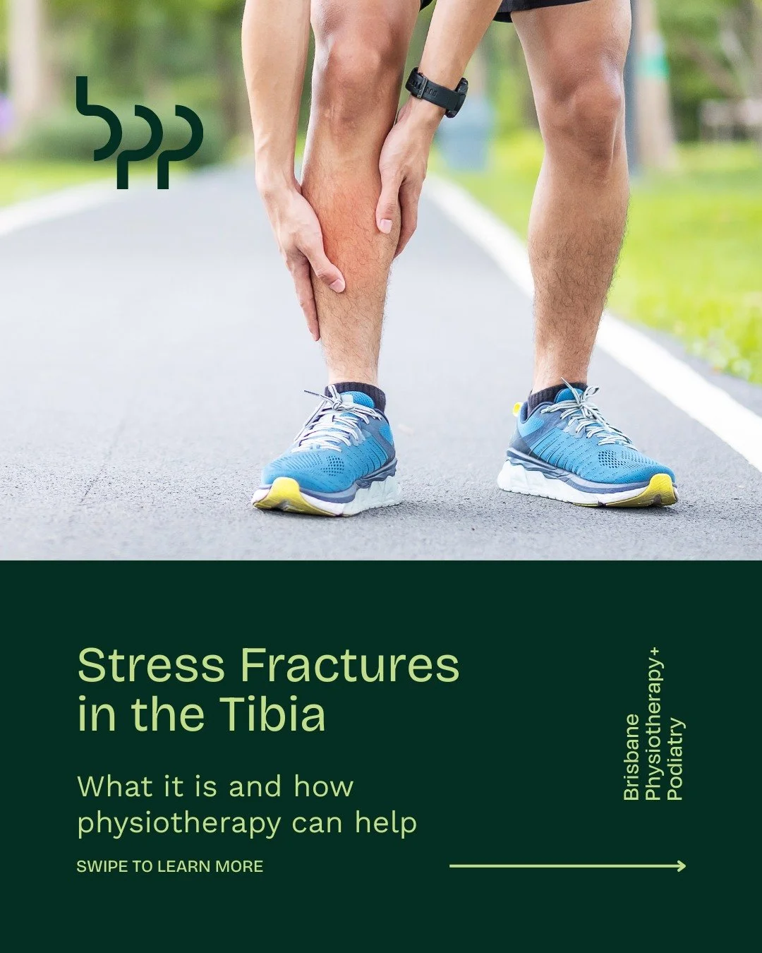 Stress Fractures in the Tibia

Persistent shin pain is more than muscle soreness. Stress fractures in the tibia, or tiny cracks in your shin bone, develop over time from repetitive loading and high-impact activities. Runners, dancers, and athletes ar