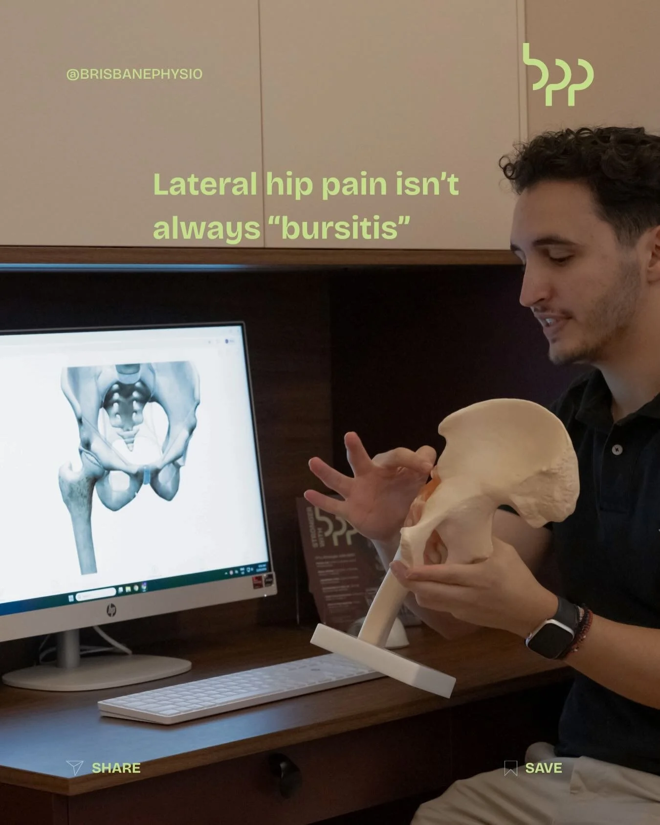 Lateral hip pain isn&rsquo;t always what you&rsquo;ve been told.

A lot of people come in thinking they&rsquo;ve got &ldquo;bursitis&rdquo; &mdash; but in many cases, the real driver is the glute tendons becoming sensitive to load.

That distinction 