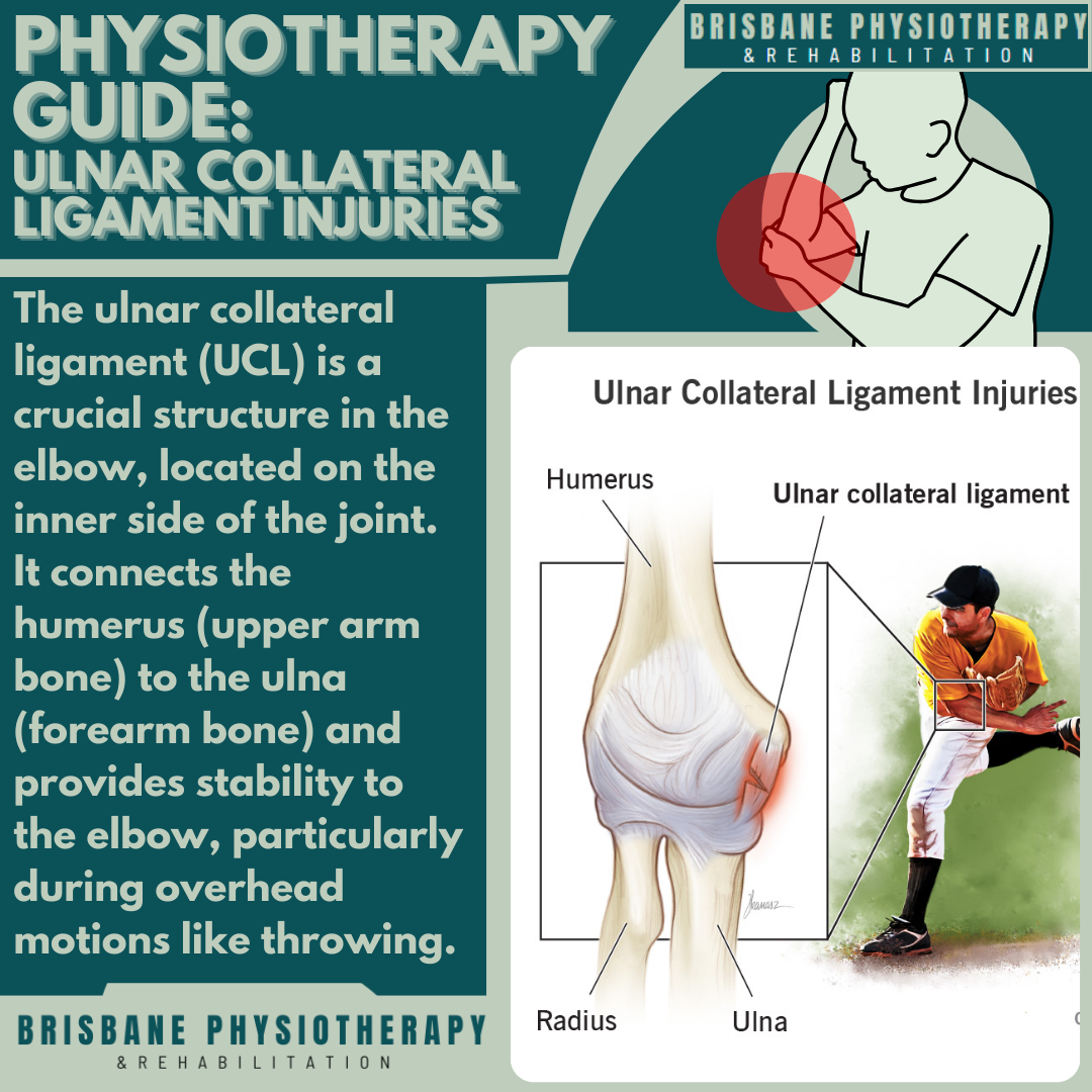Ulnar Collateral Ligament: Injury & Surgery - Brisbane Physiotherapy ...