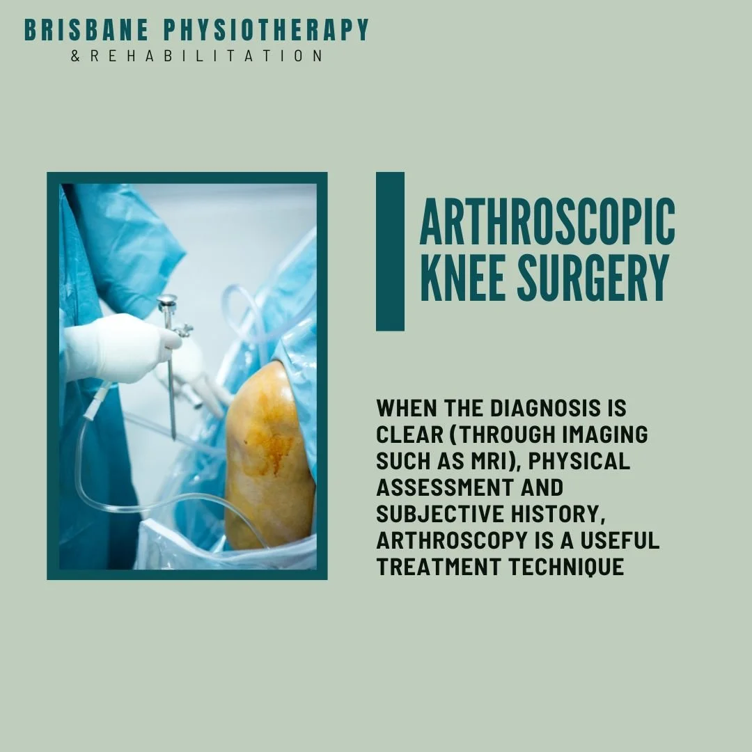 Do I need a knee arthroscopy? Brisbane Physiotherapy