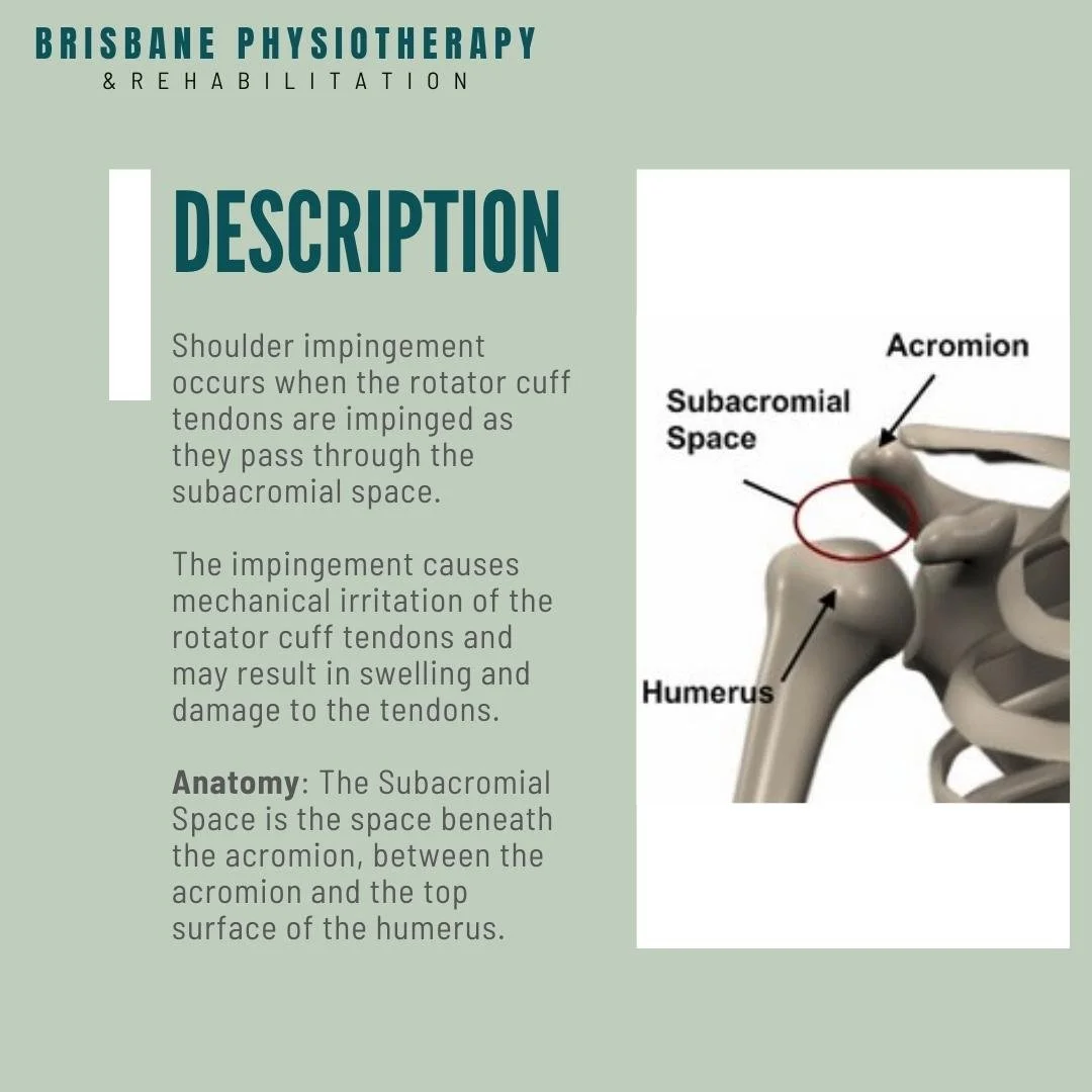 What is Subacromial Impingement? Brisbane Physiotherapy