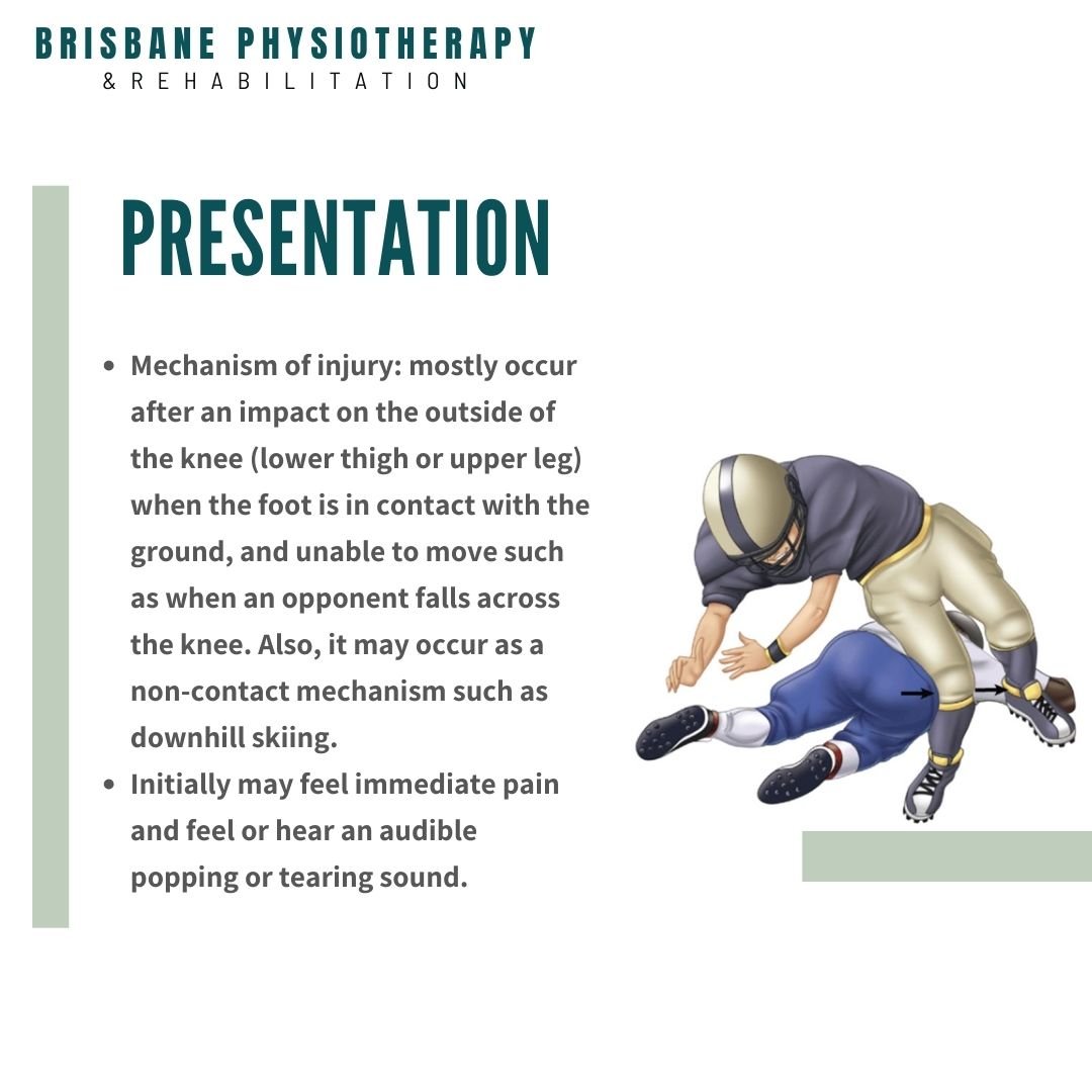 What is a MCL Injury? - Brisbane Physiotherapy