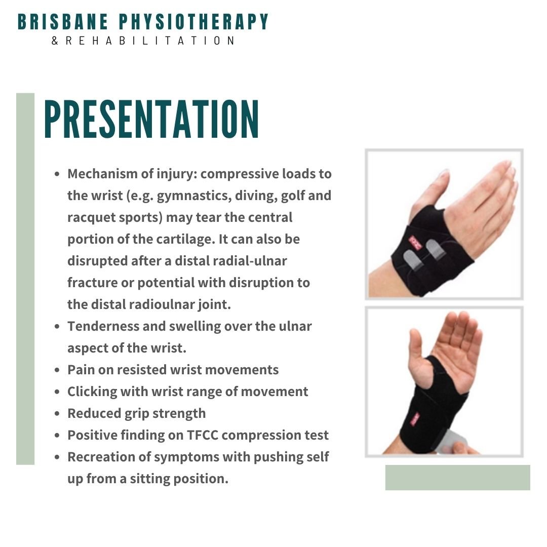 What is a TFCC tear? Brisbane Physiotherapy