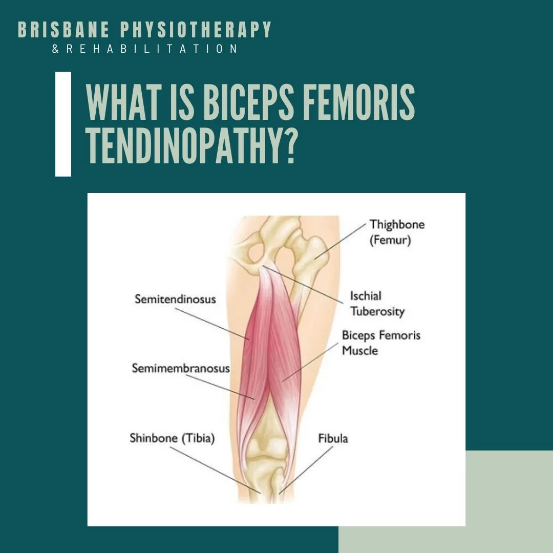 What is the Biceps Femoris and Where is it Located?