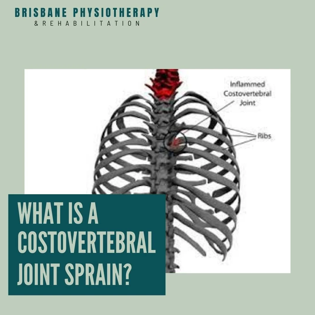 What is a Costovertebral Joint Sprain? Brisbane Physiotherapy
