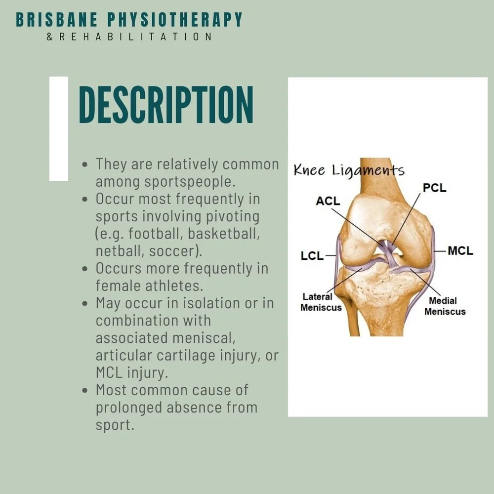 Torn ACL Injury - ACL Physio & ACL Rehab Protocol - Brisbane ...