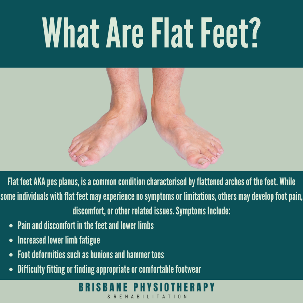 flat-feet-causes-symptoms-treatment-brisbane-physiotherapy