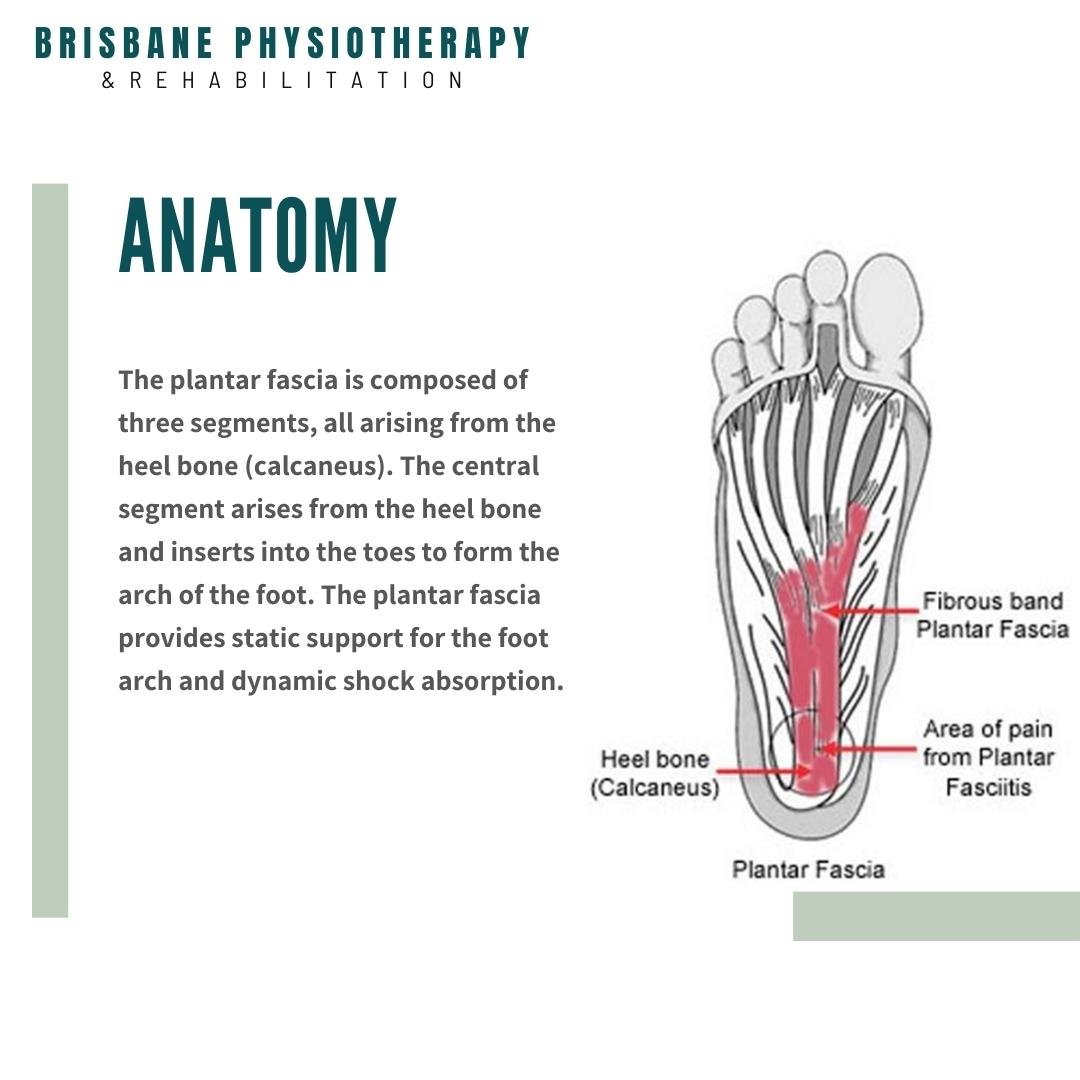 Cause and Symptoms of Plantar Fasciitis - Get Active Physiotherapy