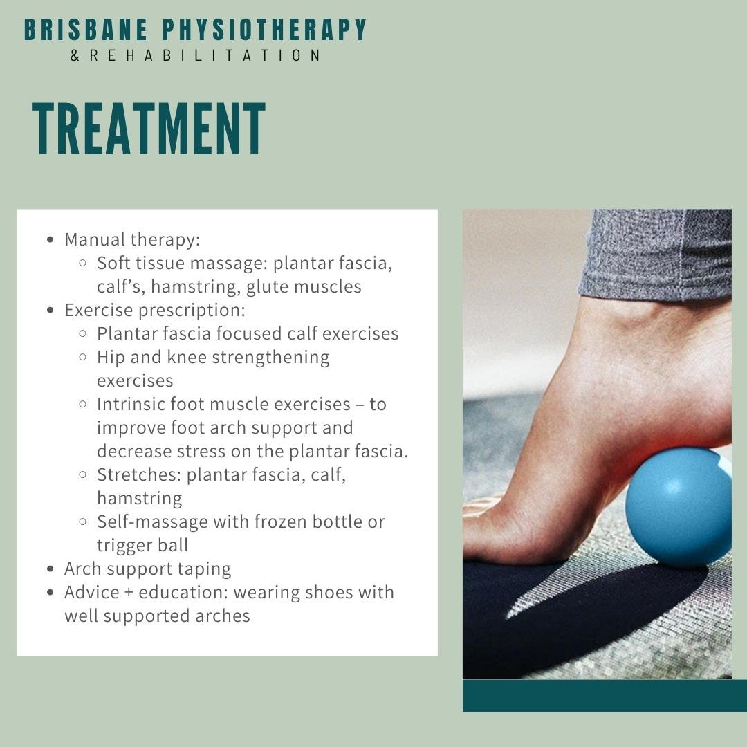 Managing Your Plantar Fasciitis Brisbane Physiotherapy